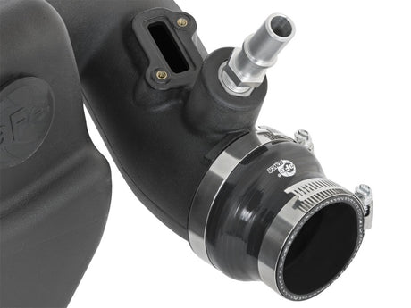 Système d'admission Momentum GT Pro DRY S Stage 2 13-16 Cadillac ATS L4-2.0L (t)